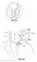 Fig. 09 - Transvascular electrode system and method