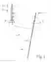 Fig. 02 - Sacral neuromodulator