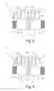 Fig. 06 - Spine Fixation System
