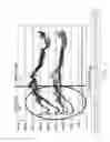 Fig. 04 - Systems and methods for activating and controlling impedance-based detection systems of implantable medical devices