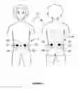 Fig. 02 - Transcutaneous stimulation method and system