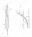 Fig. 07 - Large vessel closure device and method