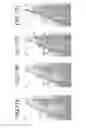 Fig. 13 - Intraocular lens insertion device