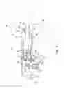 Fig. 02 - Method of controlling a prosthesis