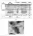 Fig. 02 - Gut flora-derived extracellular vesicles, and method for searching for a disease model, vaccine, and candidate drug and for diagnosis using the same