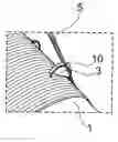 Fig. 01 - CONDUCTOR HANDLING TOOL AND A METHOD OF APPLYING AN ELECTRICALLY INSULATING MATERIAL