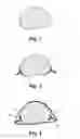 Fig. 02 - Method for producing a fibre-reinforced plastic component