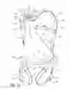 Fig. 02 - Lightweight controlled descent system with an integral reserve suspension relief strap (RSRS)