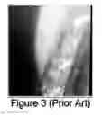 Fig. 04 - Method and apparatus for real time video imaging of the snout interior on a hot dip coating line