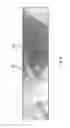 Fig. 09 - Flashless motion invariant image acquisition system