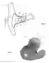 Fig. 02 - HEARING AID AND METHOD OF FABRICATING THE SAME