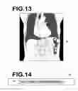 Fig. 07 - Image-based diagnosis assistance apparatus, its operation method and program