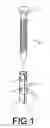 Fig. 02 - Nail anchor