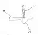 Fig. 01 - Method For Producing Individual Drilling Templates For Dental Implant Surgery In A Patient's Jawbone
