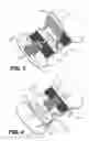 Fig. 03 - Percutaneous catheter anchoring device