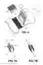 Fig. 06 - Percutaneous catheter anchoring device