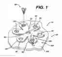 Fig. 02 - Bioabsorbable coatings of surgical devices