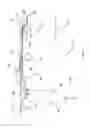 Fig. 02 - Method and apparatus for delivery of a ligating suture