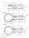 Fig. 43 - Methods and systems for performing submucosal medical procedures