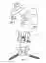 Fig. 02 - Translaminar interspinous stabilization system