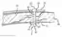 Fig. 01 - EXTRA-MEDULLARY CORTICAL BUTTRESS FIXATION DEVICE AND METHOD OF USE ASSOCIATED THEREWITH