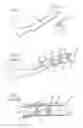 Fig. 02 - EXTRA-MEDULLARY CORTICAL BUTTRESS FIXATION DEVICE AND METHOD OF USE ASSOCIATED THEREWITH