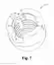 Fig. 07 - Fastener Element Retention Feature for Bone Anchors