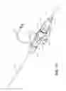 Fig. 14 - Catheter system and methods of using same