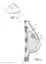 Fig. 02 - SELF SUPPORTING AND FORMING BREAST IMPLANT AND METHOD FOR FORMING AND SUPPORTING AN IMPLANT IN A HUMAN BODY