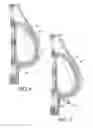 Fig. 07 - SELF SUPPORTING AND FORMING BREAST IMPLANT AND METHOD FOR FORMING AND SUPPORTING AN IMPLANT IN A HUMAN BODY