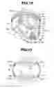 Fig. 08 - Internal combustion engine piston