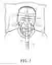 Fig. 02 - Storage device for a ventilation mask
