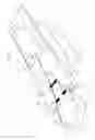 Fig. 02 - SURGICAL INSTRUMENT PLACEMENT TOOL FOR HOLDING TOOLS FOR ANGIOGRAPHIC PROCEDURES