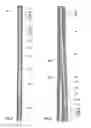 Fig. 02 - Expandable window milling bit and methods of milling a window in casing
