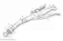 Fig. 01 - Surgical instrument buttress attachment
