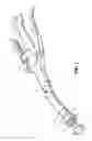 Fig. 02 - Surgical instrument buttress attachment
