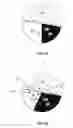 Fig. 06 - Shading system using liquid lens and light waveguide