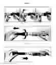 Fig. 15 - Reduced volume formulation of glatiramer acetate and methods of administration