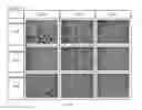 Fig. 07 - Pharmaceutical composition for inhibiting osteoclast growth