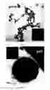 Fig. 02 - Fibrous calcium pyrophosphate particles and methods of making and using same