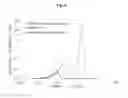 Fig. 09 - Composites of inorganic microparticles having a phosphated surface and alkaline earth carbonate nanoparticles