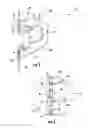 Fig. 03 - Surgical retractor and related methods