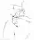 Fig. 01 - Method and corresponding kit for administering a paravertebral block
