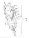 Fig. 06 - Method and apparatus for penetrating tissue