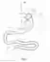 Fig. 02 - Devices and methods for endolumenal gastrointestinal bypass