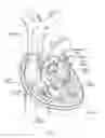 Fig. 02 - Devices, systems, and methods for reshaping a heart valve annulus, including the use of magnetic tools