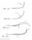 Fig. 13 - MINIMALLY INVASIVE TISSUE SUPPORT