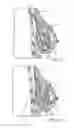 Fig. 16 - MINIMALLY INVASIVE TISSUE SUPPORT