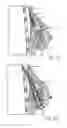 Fig. 17 - MINIMALLY INVASIVE TISSUE SUPPORT