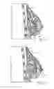 Fig. 19 - MINIMALLY INVASIVE TISSUE SUPPORT